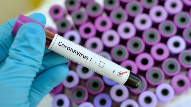 Covid-19 en Mauritanie : 3 décès et 220 nouvelles infections enregistrées ces dernières 24 heures